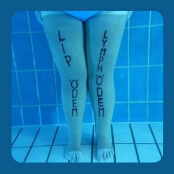 Frau steht im Wasser, ihre Beine sind mit „Lymphödem“ und „Lipödem“ beschriftet. Das Bild zeigt, bei welchen Beschwerden Aquafitness gezielt entlasten kann.